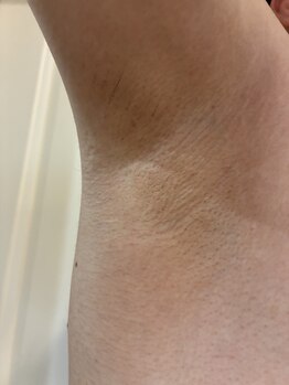 パーミル 千里丘店(per mille‰)/私のワキのお写真です♪