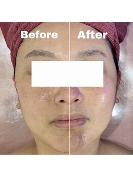 巡り専門店 Body Smile【ヘッドスパ/リンパマッサージ/ストレッチ/痩身/小顔】/◆美骨フェイシャル