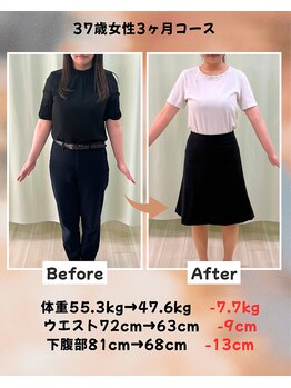 くさば整骨院/37歳女性/ダイエット3か月コース