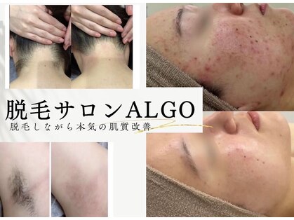 アルゴ 南茨木駅前店(ALGO)の写真