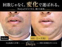 ダイヤ 名古屋中川区店(Daiya)