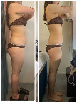 ストーミーストーン(STORMY STONE by Aphros Queen)/やく石浴VIPコース3ヶ月