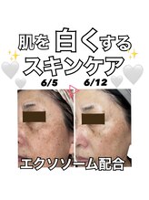 ステラ(stella)/肌の土台を整えるスペシャルケア