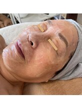 エソール(essor)/レストセルトリートメント