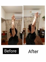 アース エンジェル整体院/ビフォアフ　肩&ストレッチ