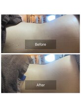 リノリー 一関店(rinory)/キャビテーションで理想のくびれ