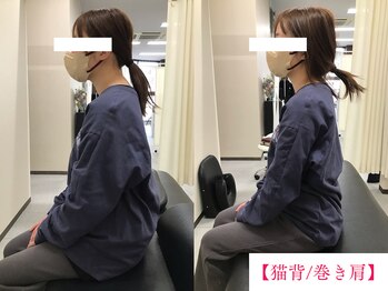 ボディメイク アールエフ サクラ接骨院(bodymake RF SAKURA接骨院)/猫背/巻き肩矯正