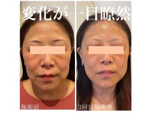 緒々 ワンプラス(one+)の雰囲気（【美容医療提携サロン】信頼と結果重視の最先端美容をご提供☆）