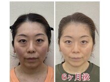 小顔22 ボルティ 本店(Bolty)/小顔シンメトリー矯正＆全身矯正