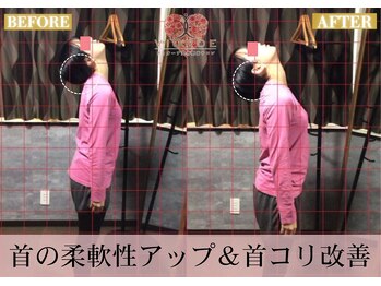 ヴィオーデ 錦糸町店/小顔、リンパ、ヘッドスパ、骨盤