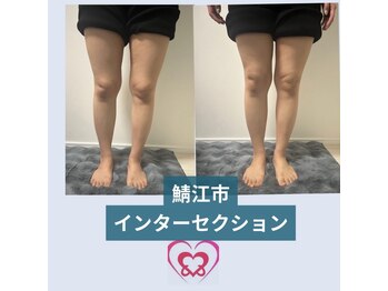 腰の整体インターセクション/むくみ改善