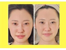 アン 銀座(ann)/レモンボトル