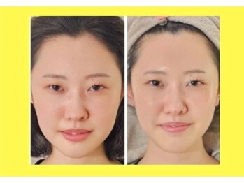 アン 銀座(ann)/レモンボトル