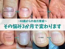 キラリネイル(KIRARINAIL)