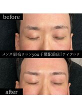 ユー 千葉駅前店(you)/ビフォ－アフター写真