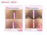 【話題のpink tone♪】革命的！デリケートゾーンメラニンケア