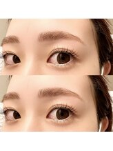 エニー アイラッシュ 筑紫口店(ANY Eyelash)/SET