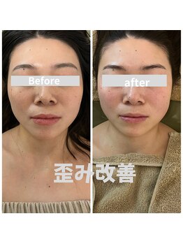 ミピマムマール(Mipimam Maaru)/お客様before→after