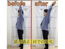 きずな鍼灸整骨院 武蔵ヶ丘本院/猫背矯正