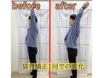 きずな鍼灸整骨院 武蔵ヶ丘本院/猫背矯正