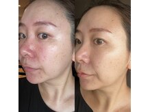 ネイルアンドビューティー モアリボン(Nail&Beauty More Libbon)の雰囲気（見た目が変われば、ココロも変わる。《結果が続く》エステ美容）