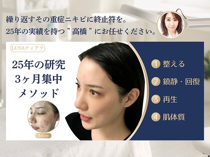 ルナティアラ(LUNAティアラ)の写真