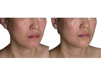 ユニ(Uni)/気付かないうち顔は間延びしてる