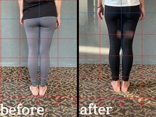 ヴレ 福岡店(Vraie)/脚の歪みを整え美尻へ導きます！