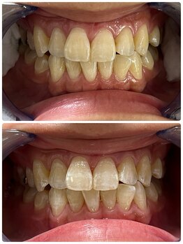 ルルネイル(Lulu Nail)/月一万円で通い放題