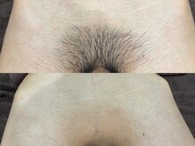 アテ 古波蔵店(ATE)の雰囲気（施術だけでなく丁寧な徹底カウンセリングで素敵な自愛時間を◎）