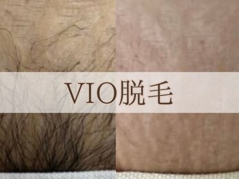 ヴィヴィオドット(vivio.)/VIO脱毛