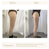 プレズィール(Plaisir)