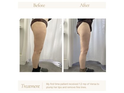 プレズィール(Plaisir)の写真