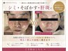 お試し♪【透明感UP】シミ・くすみ改善★毛穴/美白/肌質改善スノーピール