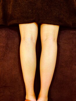 新生堂 溝の口店/◇脚全体すっきり