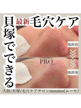 ムーモ(muumo)/毛穴のお悩みお任せください◎