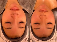 R-1ビューティーサロン 表参道/Before＆After