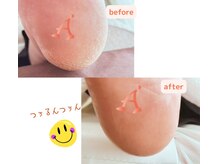 アベビー(Abeby)の雰囲気（ふわ×2,ツル×2♪これが自分の足？長年のお悩みがウソみたい！）