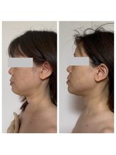 ルシアル(LUCIALL)/