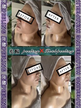 サロン ド ヴィーナス ビューティー(salon de Venus beaute)/毛穴/小顔/リフトアップ