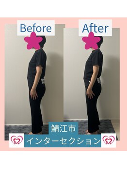 腰の整体インターセクション/美容整体