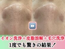 グラート(Grato)の雰囲気（1度のご来店でも結果を出してまいります！特別な日の前にも♪）