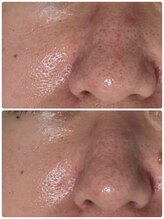 エルナ(ELUNA)/セルマン３回