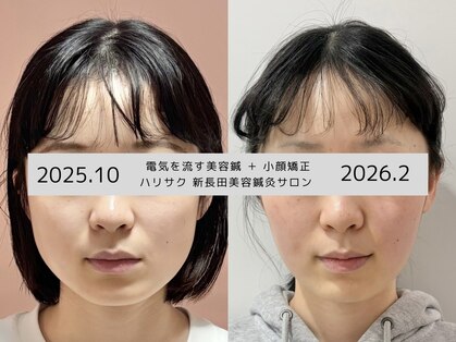 ハリサクの写真