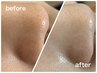 新メニュー【毛穴リセット】鼻の黒ずみ◎/ザラつきすっきりケア 通常 5,000円