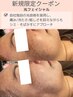 【シミ・くすみ改善】低刺激×即攻美肌◎次世代光フェイシャル¥16980→¥9980
