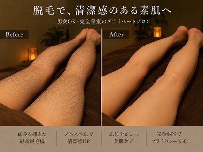 ケアビー(Care Bee)の写真