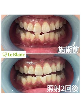 ルブラン 奈良店(Le Blanc)/タバコのヤニもスッキリ!!