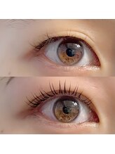 テュセ(Tu sais)/ダブルアイリフト