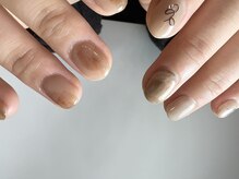 アテ(ate.)/お任せネイル